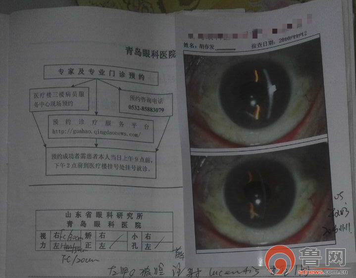 爱尔眼科流转白内障手术 术后患者眼睛直接看不清